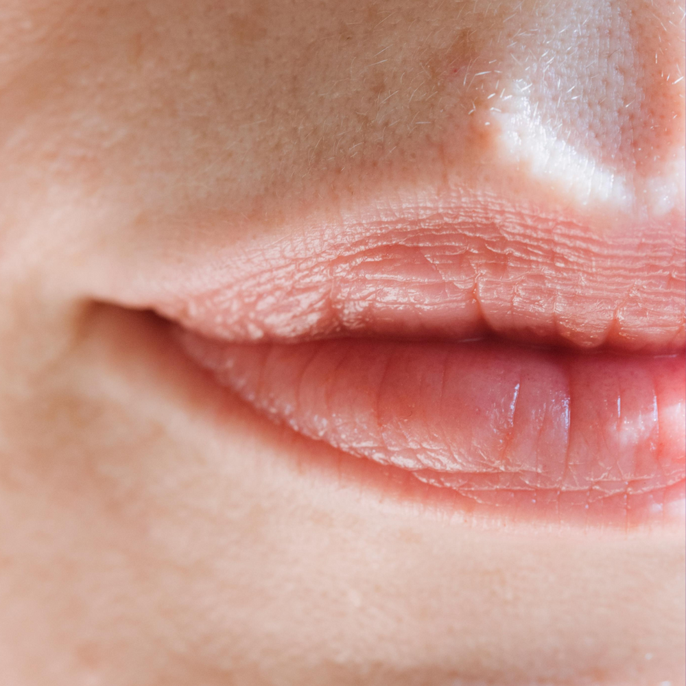 
                  
                    ChapStick Classic Strawberry Lip Balm
                  
                