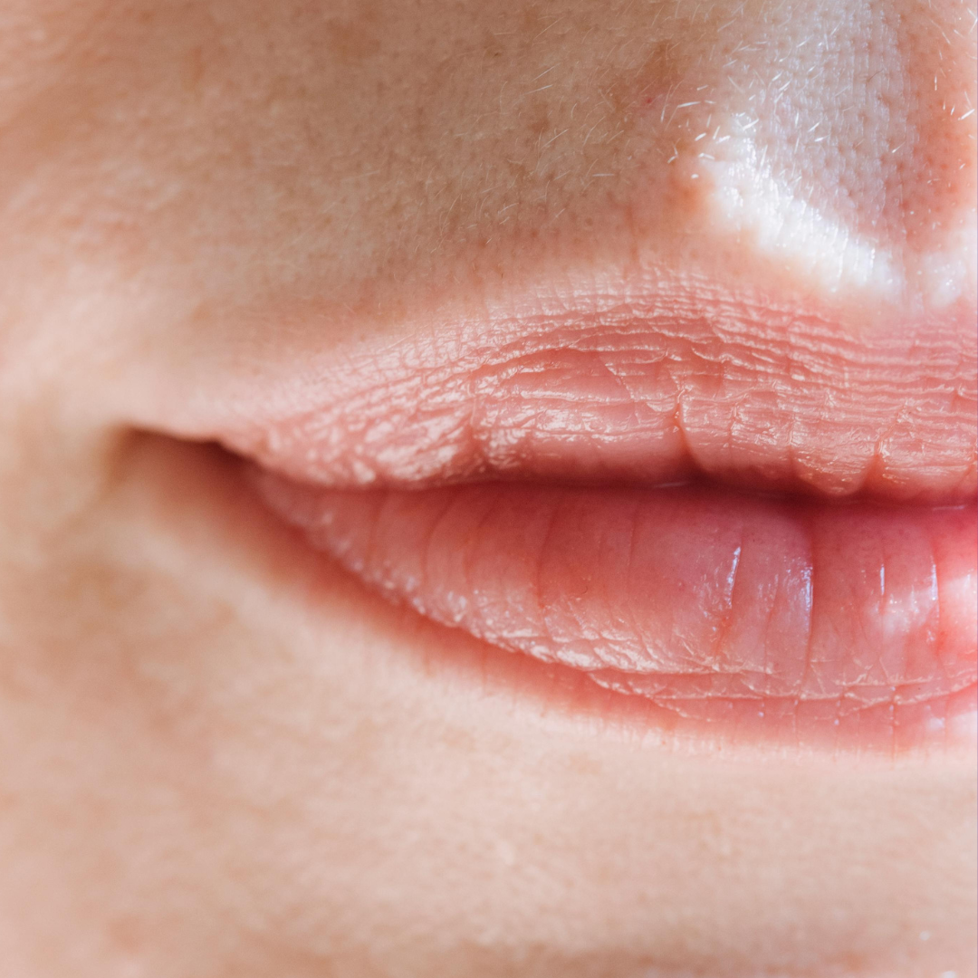 
                  
                    ChapStick Classic Strawberry Lip Balm
                  
                